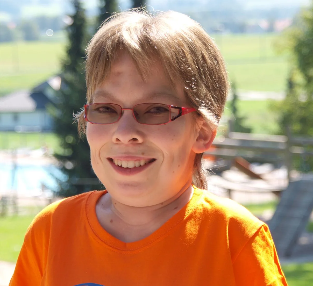 Frau mit MPS I S - Morbus Scheie