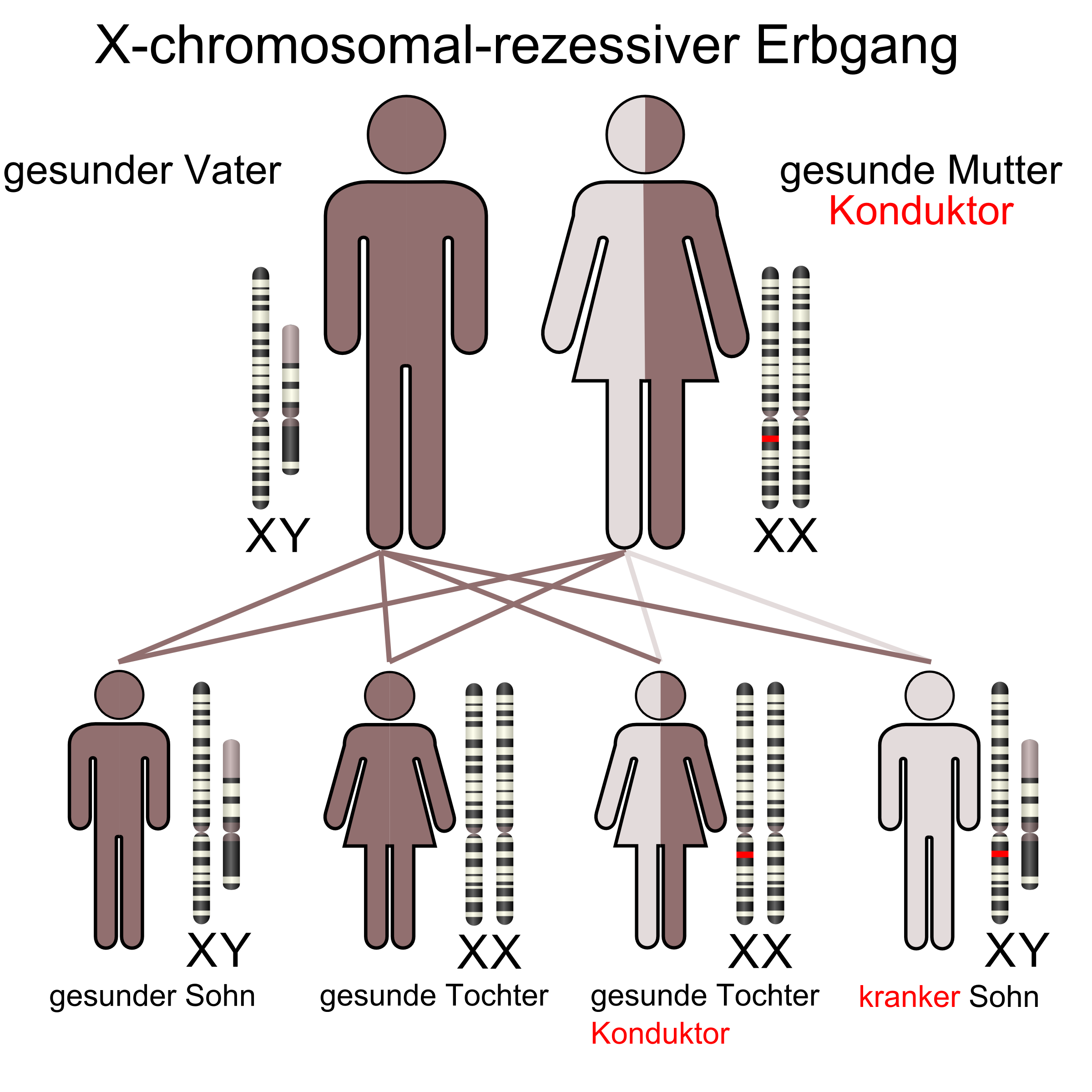 X-chromosomal-rezessive-Mutter